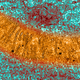 Illustration for article titled Eukaryote Traumatized After Accidentally Witnessing Parent Cell Undergo Mitosis